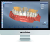 Monitor showing DentalCad 2015