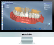 Monitor showing DentalCad 2015